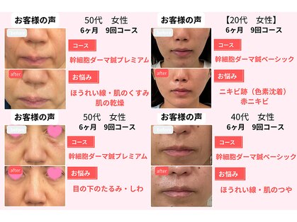 ビランシア(BILANCIA)の写真