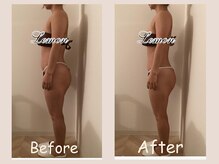 レモン(Lemon)/ビフォーアフター