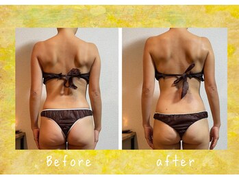 マタハリ(Matahari)/4D筋膜リリース