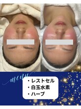 リヴィア(LIVIA)/美肌と同時に小顔もゲット！