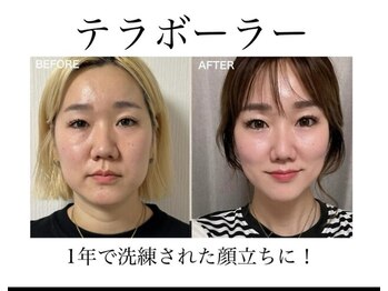 ラビジェ(Labbija)の写真/速攻小顔を実感！首まで変わってくるのを体験して◎小顔になりたい方は特におすすめ！