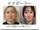 ラビジェ(Labbija)の写真/速攻小顔を実感！首まで変わってくるのを体験して◎小顔になりたい方は特におすすめ！