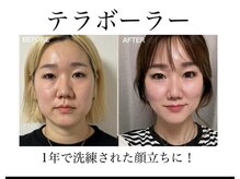 ラビジェ(Labbija)