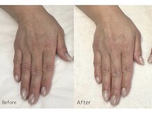 レアノアネイル(Leano'a Nail)の雰囲気（美容成分で包み込み、ワントーン明るい手元へ）