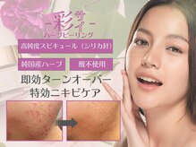 シエスタ(siesta)の雰囲気（ハーブピーリング/毛穴/毛穴洗浄/毛穴ケア/毛穴改善/ララピール）