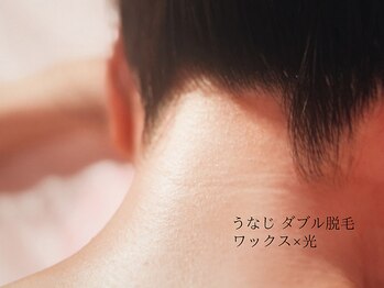 レネットサロン(Reinette Salon)の写真/【魅せるうなじ】ワックス×光ダブル脱毛で理想の美フォルムに　初回5,500円