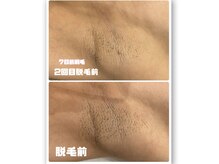 サロン ド ララ(Salon de LALA)の雰囲気（清潔感は肌で決まる♪男性も大歓迎！ツルツル美肌目指しましょう）