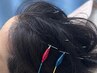 ２回目以降【睡眠不足・脳疲労】頭皮鍼（微弱電流付き）頭と心の休息