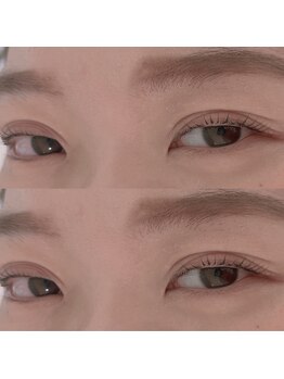 ジョリー(Jolie)/