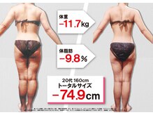 セントラヴィ 川崎店/Before After【20代女性(4)】