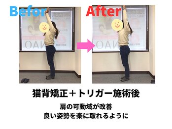 ナオル整体 勝田台院(NAORU整体)/猫背矯正ビフォーアフター