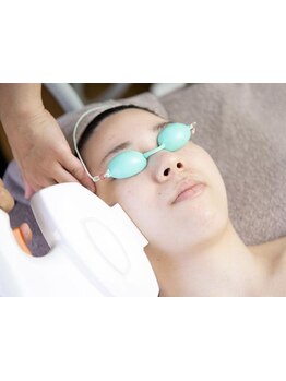 顔脱毛がしたい