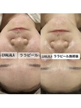 グラン ジュテ/LHALALA &nbsp;ララピール