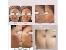 ダリア(Dahlia)の雰囲気(肌質・お悩みに合わせてご案内いたします^^最高の美肌に♪)