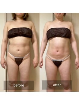 ココカラ(COCOKARA)/インディバ&アロマ痩身