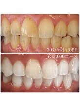 ホワイトニングルーム 川崎店(WhiteningRoom)/ホワイトニング/川崎