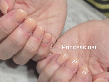 プリンセスネイル(Princess nail)/深爪矯正