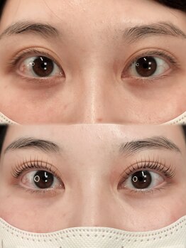 アイモア 吉祥寺店(eye mor.)/まつげパーマ/眉毛/アイブロウ