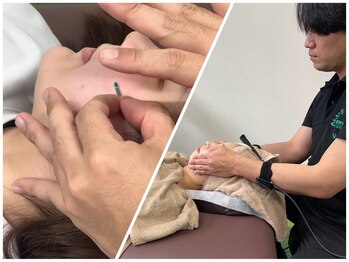 ナゴミ鍼灸 整体院(NAGOMI鍼灸 整体院)の写真/むくみを流して引き上げる小顔ケア。鍼×ラジオ波でスッキリ小顔☆