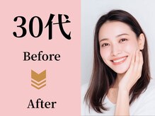 アメリイ 百合ヶ丘 新百合ヶ丘(Amerii)/【30代】ダイエット痩身の実績