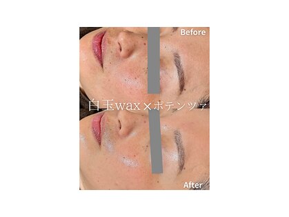 美肌専門サロン Mielの写真
