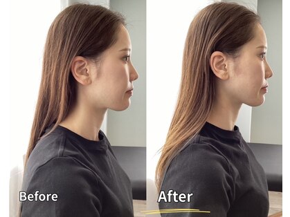 ナチュラルエイジングプラス(naturalaging+)の写真