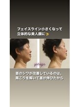 よす香/ビフォーアフター