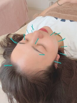 ヒーリングサロン アージュ(A-je)/★美顔鍼＋小顔矯正★