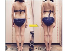 整体 美容サロン フェールラヴィ/【整体+痩身】