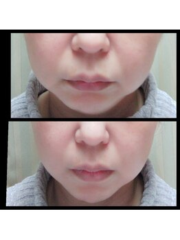 ビューティースリム タニダ/