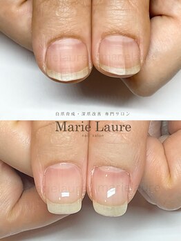 マリーロール 淀屋橋本店(Marie Laure)/自爪育成/深爪矯正/ネイルケア