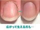 キラリネイル(KIRARINAIL)の写真
