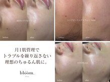 ブルーム(bloom.)