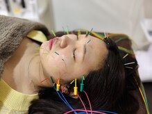 フラット(flat)/美容鍼で小顔・むくみケア