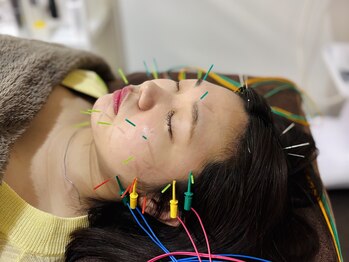 フラット(flat)/美容鍼で小顔・むくみケア