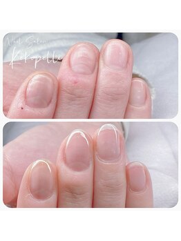 ココペリ(Nail Salon＆School kokopelli)の写真/自爪育成をケアで叶える！深爪や巻爪ケア、二枚爪に寄り添う美爪サロンです♪