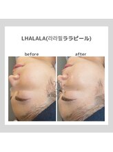 ポムハヌル(pom.haneul)/韓国肌管理室