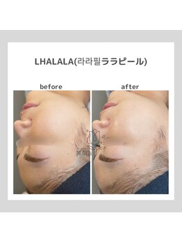 ポムハヌル(pom.haneul)/韓国肌管理室