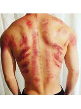 足優 赤坂(あしゆう)/カッサ！