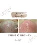 再来【学割Ｕ24】毛穴洗浄＆角栓吸引+鎮静パック ¥4,400（施術時間40分）