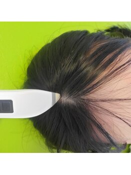 はり灸心音/頭鍼比較-スペシャル☆☆☆