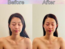 リストアハート(Restore Heart)/リフトアップお顔スッキリ♪