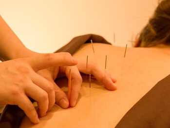 ジネコラボ 横浜(Gyneco-labo)/女性に合わせた鍼灸アプローチ