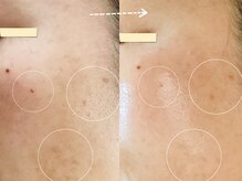 セレーノ/ビフォーアフターのご紹介