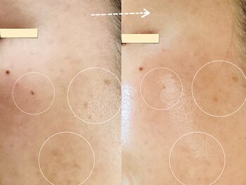 セレーノ/ビフォーアフターのご紹介