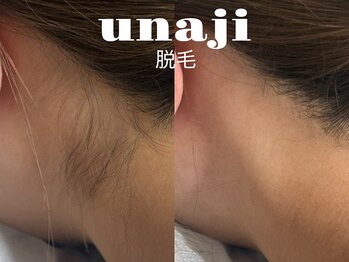 ラティエ(Latier)/うなじ美人/うなじ脱毛