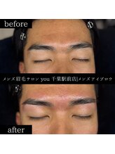 ユー 千葉駅前店(you)/ビフォ－アフター写真