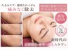 プラズマフェイシャル★顔・首イボ取りケア|痛み少なく美肌★体験¥8800