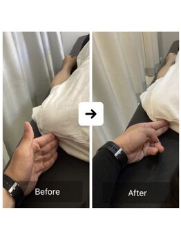 ナオル整体 三宮院(NAORU整体)/30代男性整体事例【巻き肩】