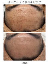 リノ(Lino)/男性にも大人気♪